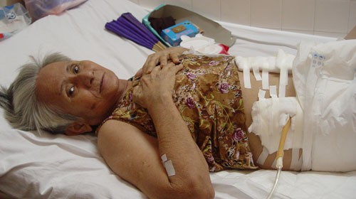 Bà Mai nằm điều trị tại khoa ngoại tổng hợp Bệnh viện Sài Gòn (TP.HCM) - Ảnh: QUỐC NGỌC